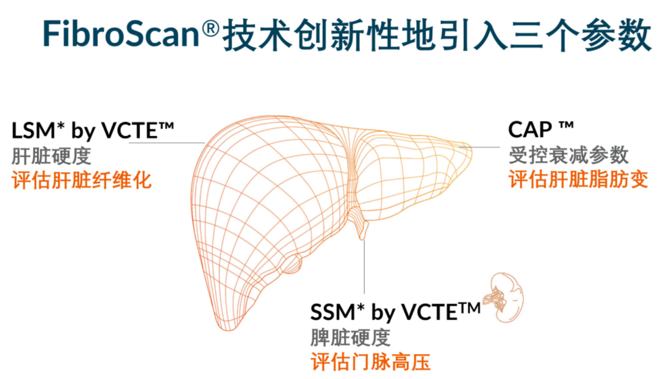 喜訊！FDA擴(kuò)大了FibroScan?在肝臟綜合管理中的應(yīng)用范圍